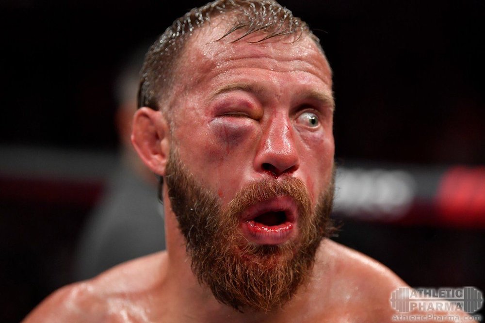 ufc_boec_cmeshnoe_lico.jpg